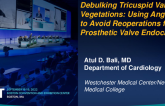 TCT 694: Debulking Tricuspid Valve Vegetations: Using AngioVac to Avoid Reoperations for Prosthetic Valve Endocarditis