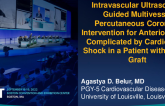 TCT 632: Intravascular Ultrasound-Guided Multivessel Percutaneous Coronary Intervention for Anterior STEMI Complicated by Cardiogenic Shock in a Patient With Cabrol Graft 