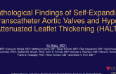 Pathology of Self-Expanding Transcatheter Aortic Valve Failure and Hypo-Attenuated Leaflet Thickening (HALT)