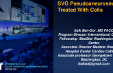TCT 745: SVG Pseudoaneurysm Treated With Colis 