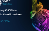 Integrating 4D ICE into Tricuspid Procedures