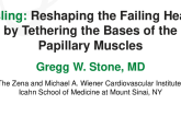 Reshaping the Failing Heart by Tethering the Bases of the Papillary Muscles