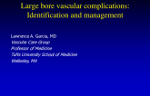 Keynote Lecture: Large Bore Vascular Complications: Identification and Management