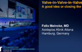 TCT 702: Valve-in-Valve-in-Valve TAVR - A good idea or closing the box?