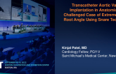 TCT 827: Transcatheter Aortic Valve Implantation in an Anatomically Challenged Case of Extreme Aortic Root Angle Using Snare Technique   