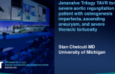 TCT 678: Jenavalve Trilogy TAVR for severe aortic regurgitation in patient with osteogenesis imperfecta, ascending aneurysm, and severe thoracic tortuosity