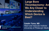 Large Bore Thrombectomy: Are We Any Closer to Understanding Which Device Is Best?