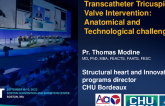 Transcatheter Tricuspid Valve Intervention: Anatomical and Technological Challenges