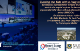 TCT 618: Turning the Tide with a Plug in the Hole: Successful transcatheter closure of post-infarct ventricular septal rupture in the context of myocardial infarction without obstructive coronary artery (MINOCA)
