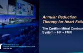 Annular Reduction Therapy For Heart Failure