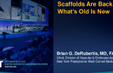 Scaffolds Are Back: What's Old Is New