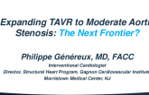 Expanding TAVR to Moderate Aortic Stenosis: The Next Frontier?
