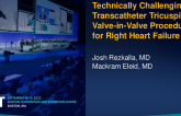 TCT 639: Technically Challenging Transcatheter Tricuspid Valve in Valve Procedure for Right Heart Failure