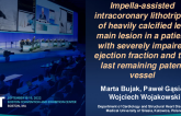 TCT 777: Impella-assisted intracoronary lithotripsy of heavily calcified left main lesion in a patient with severely impaired ejection fraction and the last remaining patent vessel