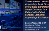 TCT 734: Transcatheter Left Atrial Appendage Closure with a Gore Cardioform Septal Occluder in a Patient with Failed Surgical Left Atrial Exclusion 