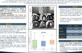 TCT 263: Viability and ischemia assessment in chronic coronary total occlusions according to collaterals distribution: a stress CMR study