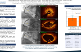 TCT 134: Vascular healing of native coronary artery lesions following treatment with drug-coated balloons – Insights from an OCT study