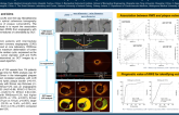 TCT 308: Correlation of radial wall strain derived from coronary angiography with plaque composition and vulnerable features