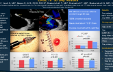 TCT 343: Evaluation of an Implant Free Interatrial Shunt to Improve Heart Failure: EASE HF