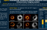 TCT 307: In vivo characterization of coronary plaques: findings from a novel hybrid intravascular ultrasound-optical coherence tomography intracoronary imaging system