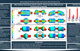 TCT 174: Comparison of Thrombotic Risk Between Coronary Artery Aneurysm and Coronary Ectasia Based on Hemodynamic Parameters 