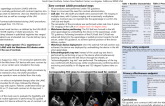TCT 389: First Report of Percutaneous Left Atrial Appendage Occlusion with Watchman FLX with TEE Guidance and Zero-contrast 
