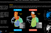 TCT 273: Relationship Between Coronary Volume, Myocardial Mass and Post-PCI Fractional Flow Reserve