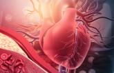 Anatomic Disease After PCI Linked With Worse Outcomes: VA CART 