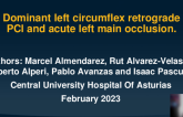Dominant Left Circumflex Retrograde PCI and Acute Left Main Occlusion