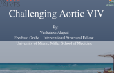 Challenging Aortic VIV