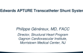 LA  to Coronary Sinus: The Edwards APTURE Shunt