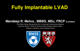 Fully Implantable LVAD