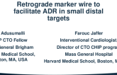 Single Guide to Accomplish Retrograde CTO of LAD via Septal to Septal Pathway in a Failed Antegrade Approach Using tip in Technique
