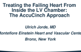 Treating the Failing Heart From Inside the LV Chamber: The AccuCinch Approach
