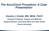 The AccuCinch Procedure: A Case Presentation