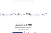 Tricuspid Valve – Where are we?