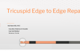 Tricuspid Edge to Edge Repair