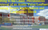 Cutting to the Chase. Percutaneous Retrieval of an Aortic Valve Leaflet Causing Severe Regurgitation and Cardiogenic Shock 