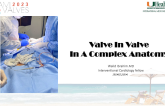 Valve In Valve In A Complex Anatomy