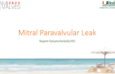Mitral Paravalvular Leak