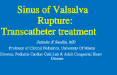 Sinus of Valsalva Rupture: Transcatheter treatment