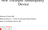 New Tricuspid Annuloplasty Device