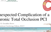 Unexpected Complication of a Chronic Total Occlusion PCI