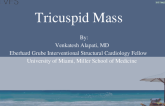 Tricuspid Mass