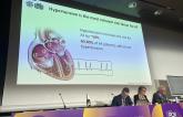 Renal Denervation: Exploring Its Potential Beyond Hypertension