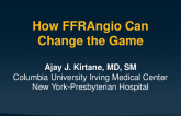 How FFRangio is Changing the Game