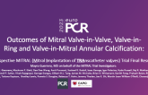 Outcomes of Mitral Valve-in-Valve, Valve-in- Ring and Valve-in-Mitral Annular Calcification: Prospective MITRAL (Mitral Implantation of TRAnscatheter vaLves) Trial Final Results