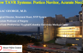 An Introduction to Other New TAVR Systems (Portico Navitor, Accurate Neo 2)