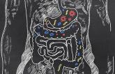 Strep Bacteria in Gut Flora Tied to Subclinical CVD
