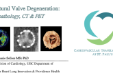 Structural Valve Degeneration: Histopathology, CT & PET